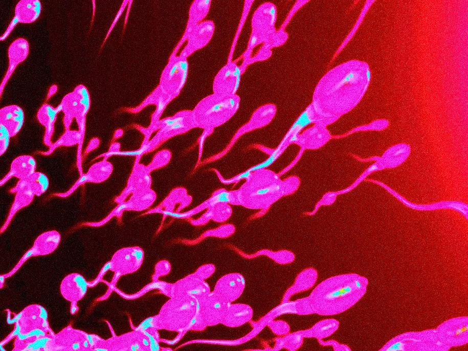 Discoloured semen: Signs, Symptoms, and When to Seek Help?