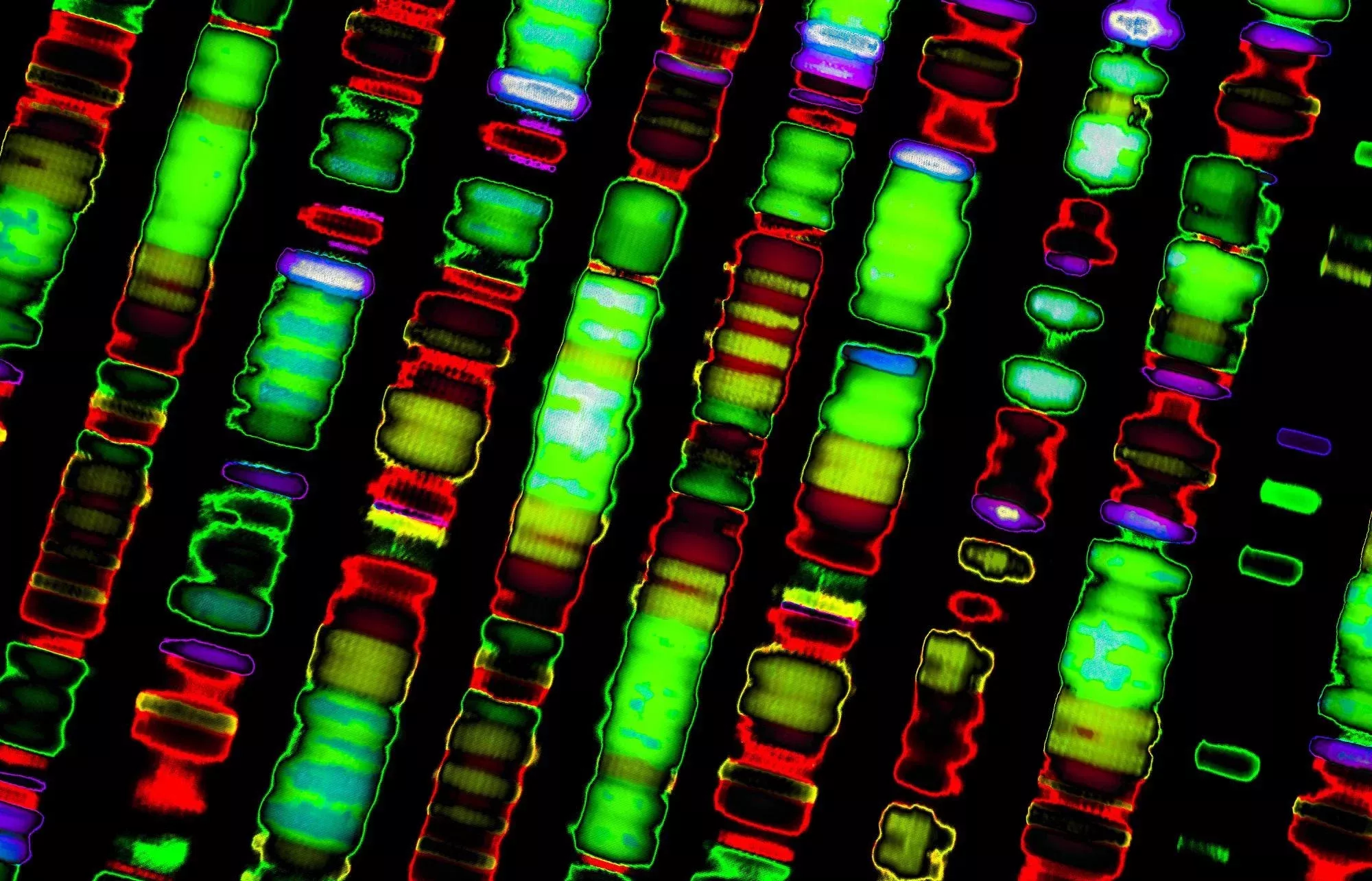 The Advantages of Using Multiplex PCR for the Simultaneous Detection of 14 Sexually Transmitted Diseases (Part 2) | Most advanced DNA test in Bangkok, Pattaya, Phuket, Thailand