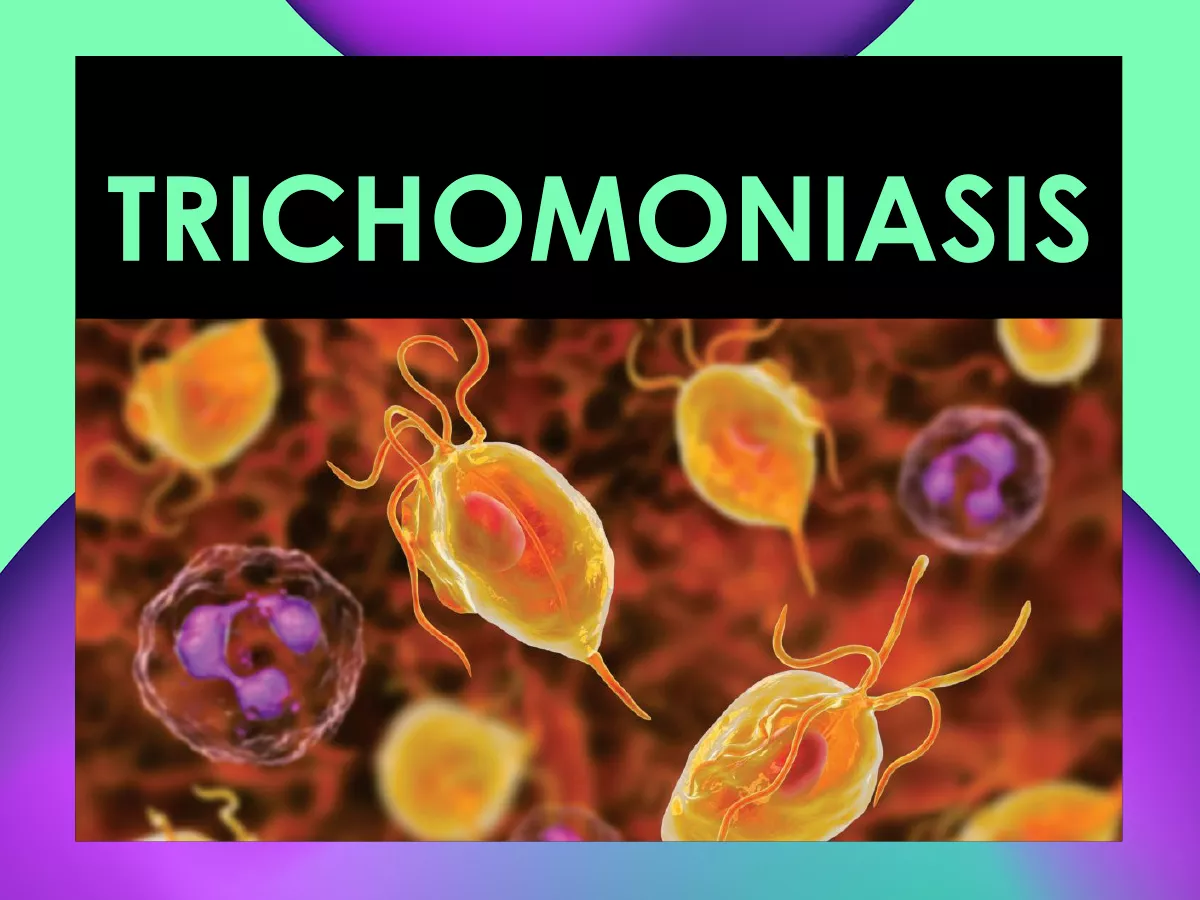 Tricomoniasis