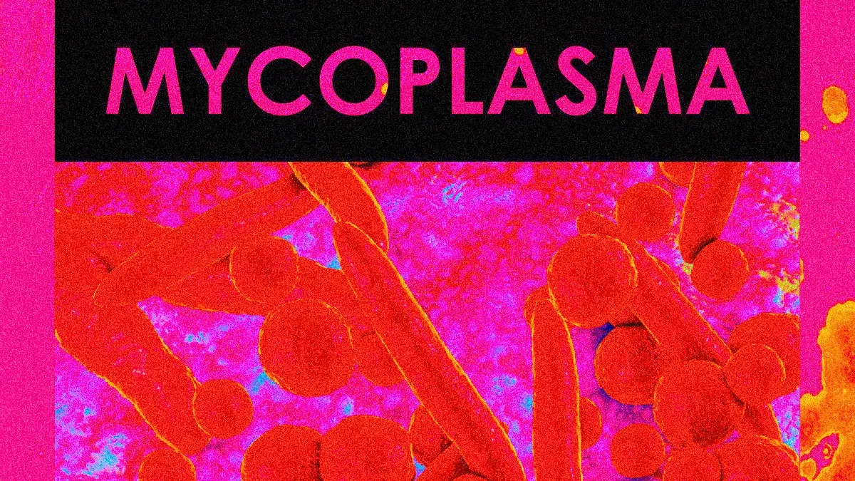 หนองในเทียมจากเชื้อ Mycoplasma hominis