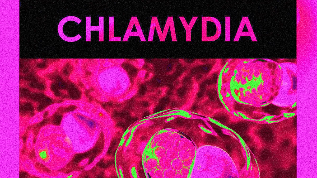 CHLAMYDIA