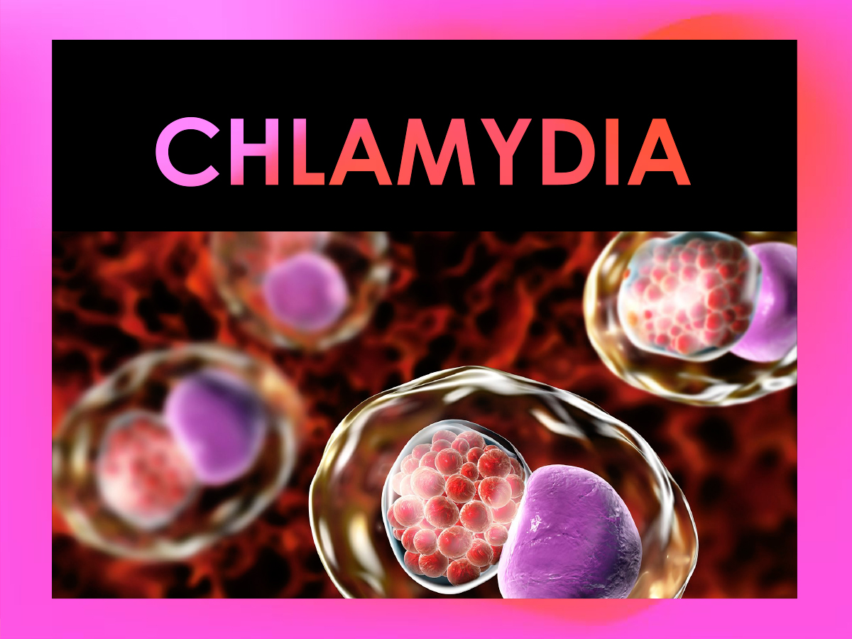 โรคหนองในเทียมคลามายเดีย (Chlamydia)