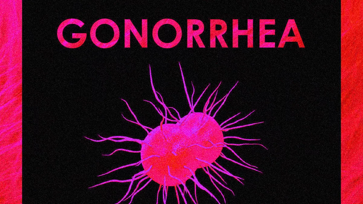 GONORRHEA